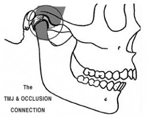 TMJ-occlusion