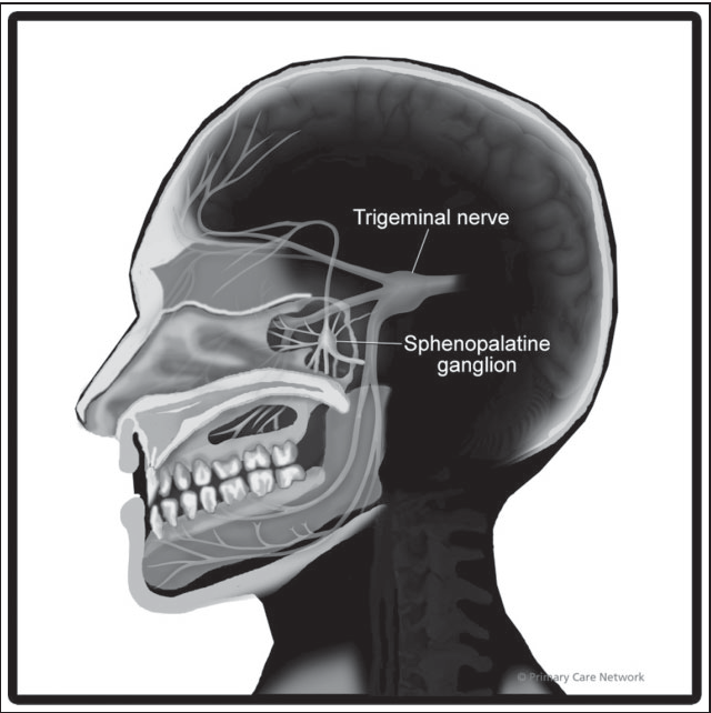 Sphenopalatine Ganglion Block Specialist 8738