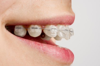 tmj-orthodontics