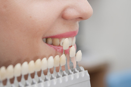 Dental Veneers: Artistry in Dentistry